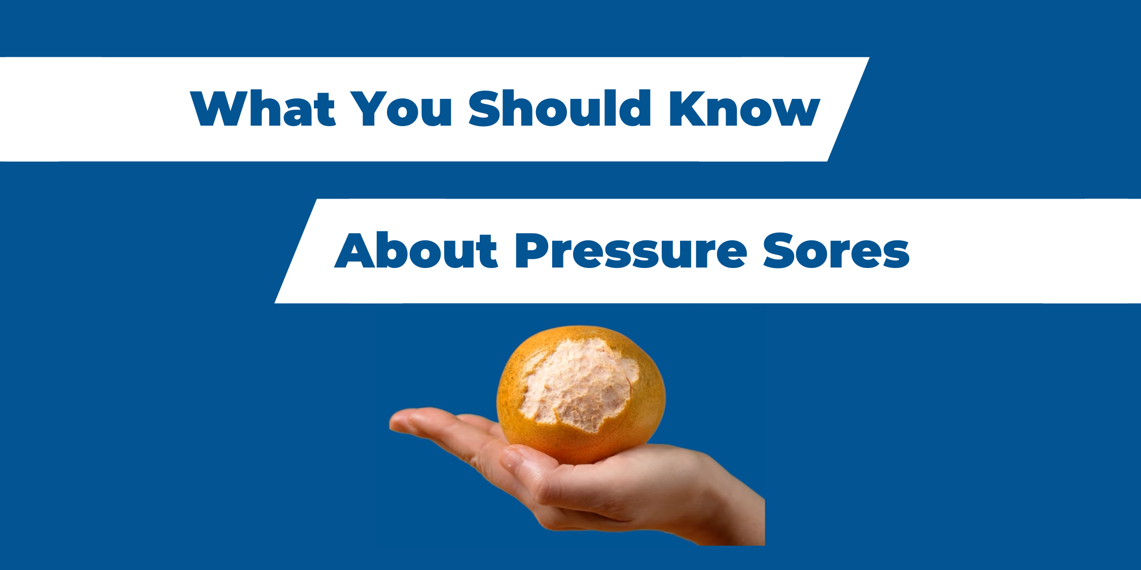 what-you-should-know-about-pressure-sores-join-nchpad-connect